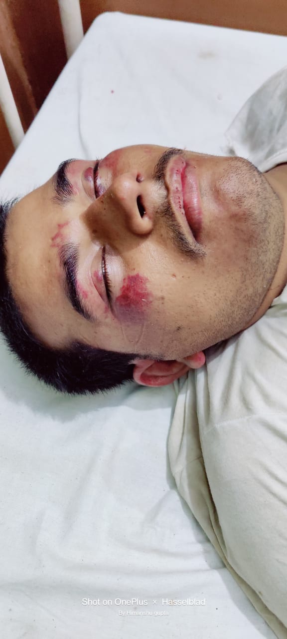 थाने में विहिप नेता की हुई जमकर पिटाई , पुलिस पर पीटने के आरोप , विहिप नेता की हालत गम्भीर
