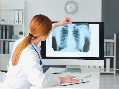 2025 तक देश होगा टीबी से मुक्त! मरीजों को फूड बास्केट परिजनों को रोजगार की ट्रेनिंग