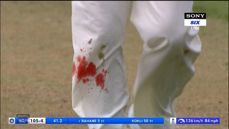 जब कोहली और रहाणे क्रीज पर थे तब एंडरसन को घुटने में चोट लगी खून बहने के बावजूद बॉलिंग करते रहे