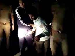 बागपत में पुलिस की बदमाश से मुठभेड़ पैर में गोली मारकर दबोचा अस्पताल में कराया भर्ती तमंचा और कारतूस बरामद