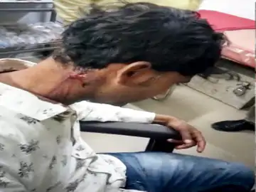 BJP विधायक के काफिले से फायरिंग का आरोप FIR दर्ज कर CCTV की जांच में जुटी पुलिस